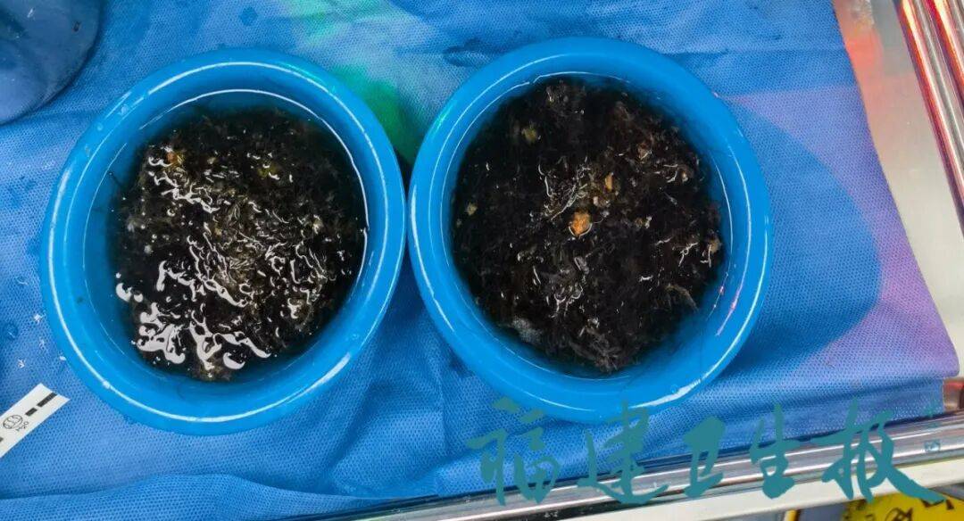 皇冠信用網在线注册_发现一例皇冠信用網在线注册，10岁女孩确诊！已有多起病例，有人因羞耻感延误就医