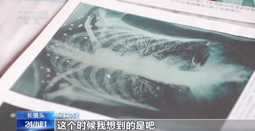 皇冠信用盘可以占几成
_“老先生皇冠信用盘可以占几成
，您把项链取下来再做CT”