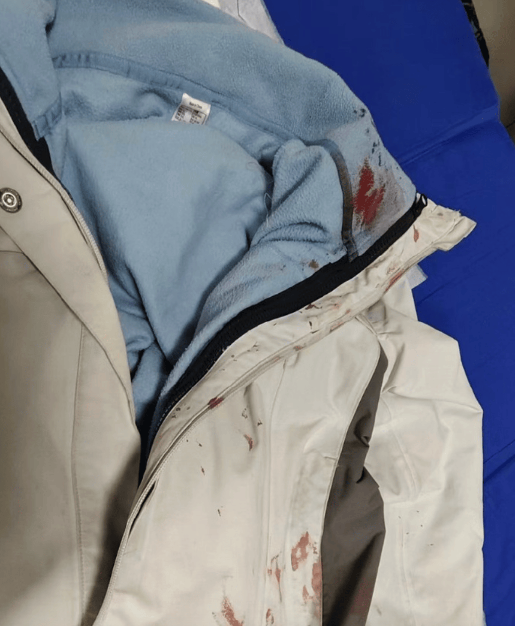 正版皇冠信用网代理_河南一男子街头挥刀乱刺正版皇冠信用网代理，被休假女警一脚踢落凶器！女警面部缝合30余针，手套被血浸透